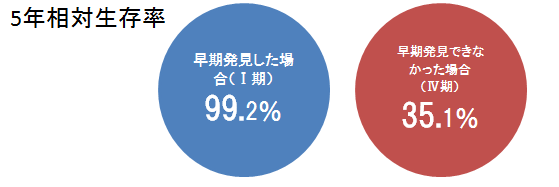 5年相対生存率 左:早期発見した場合(1期)99.2%と書かれた青丸。右:早期発見できなかった場合(4期)35.1%と書かれた赤丸
